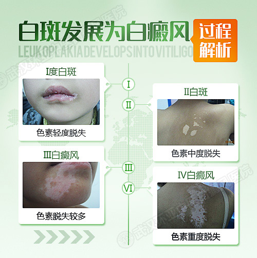 TIM图片20181120095640.jpg